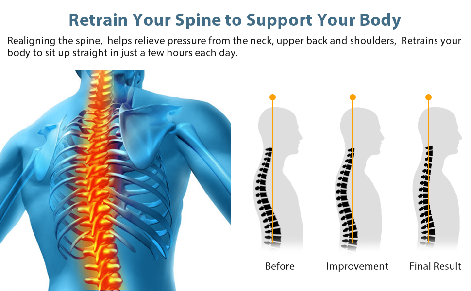 Retain Your Spine